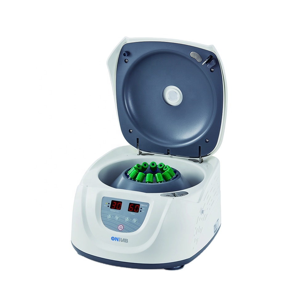 Consider When Buying Centrifuges for Medical Laboratories